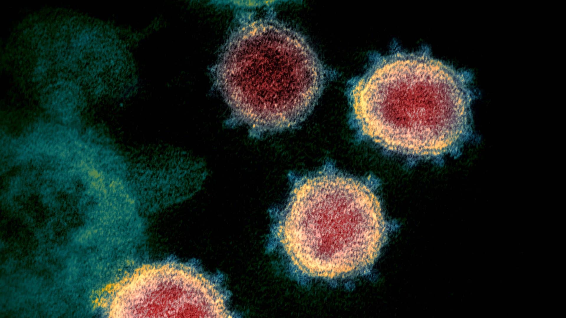 List of ‘priority pathogens’ that pose greatest risk to public health is published