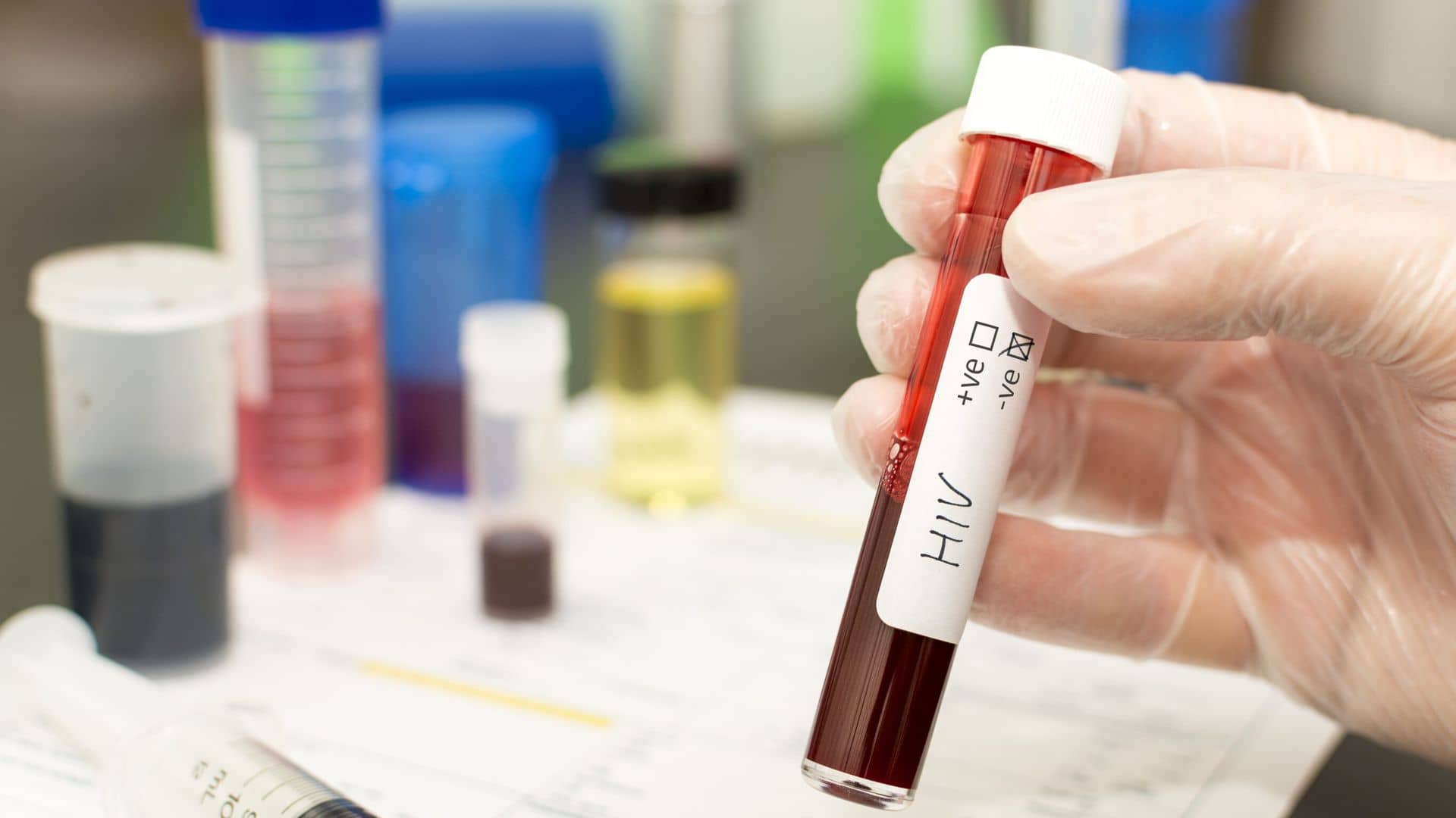 HIV deaths and infections will rise as a result of foreign aid cuts, study warns