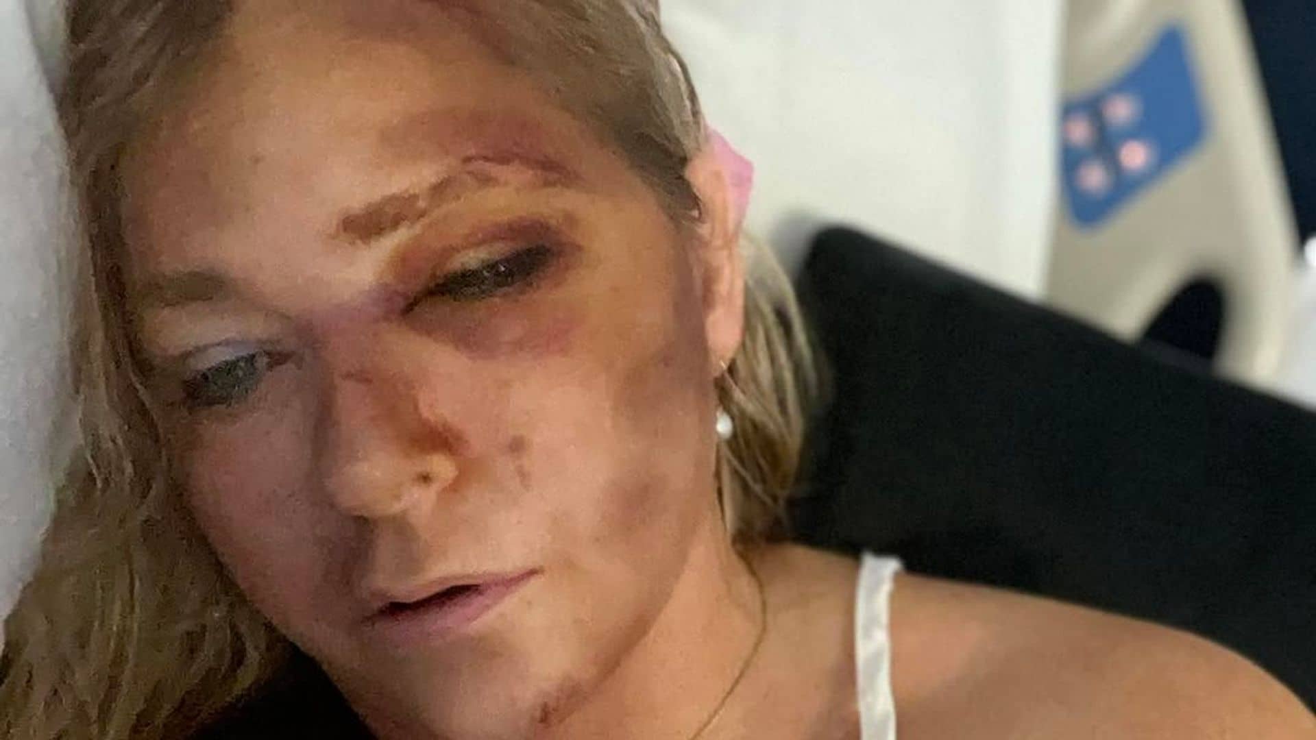 Virginia Giuffre ‘overwhelmed’ with support after saying she had days to live